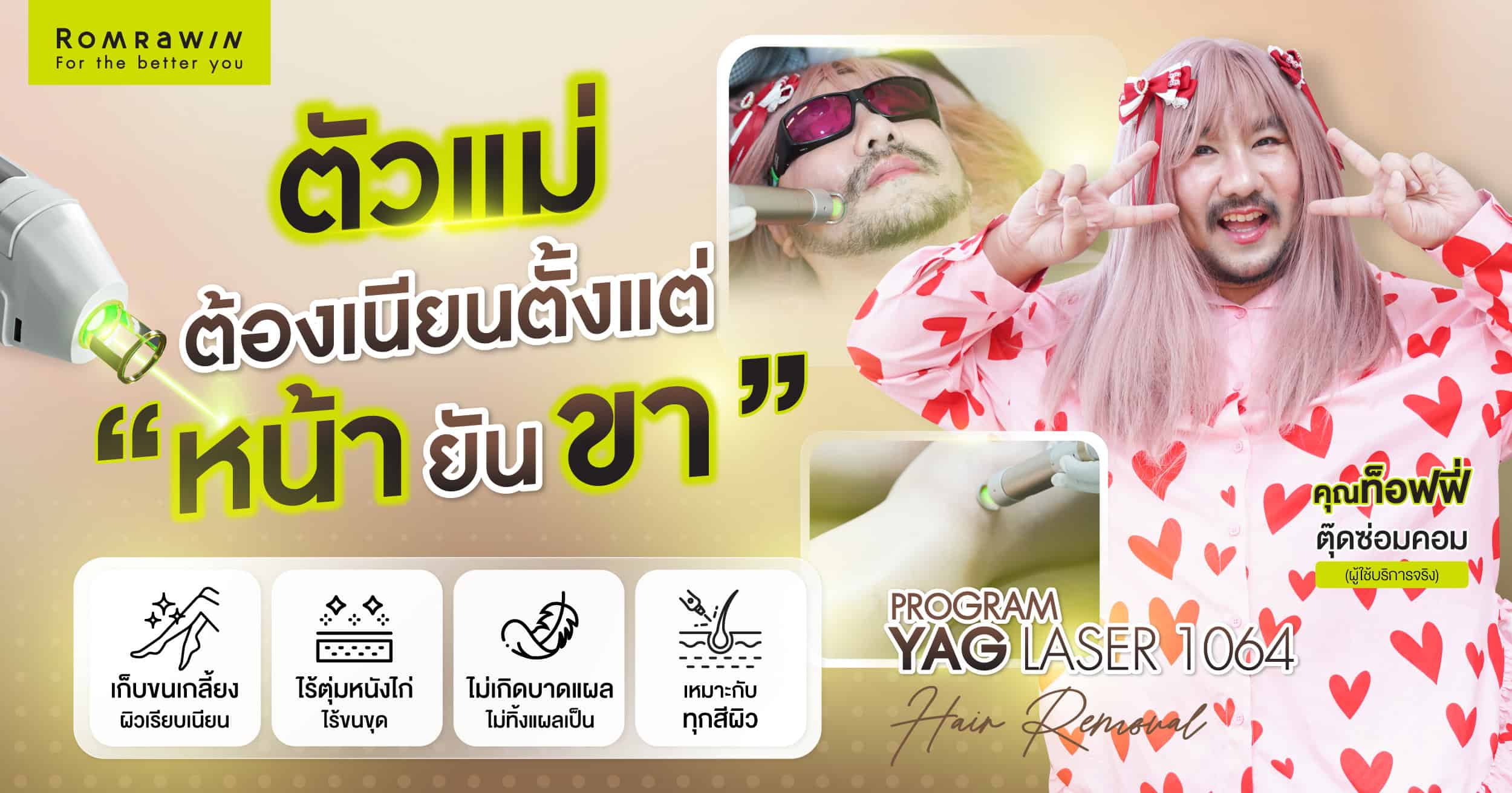 จัดระเบียบหนวดให้คุณท็อฟฟี่มั่นใจ ไม่มีรก ด้วยโปรแกรม YAG LASER 1064
