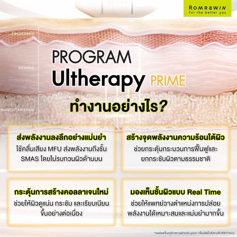 Ultherapy ทำงานอย่างไร?