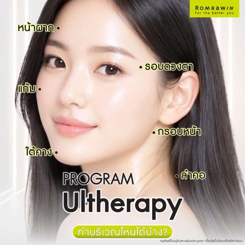 ทำ Ulthera (อัลเทอร่า) บริเวณไหนได้บ้าง?