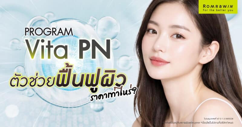 Vitaran ราคา