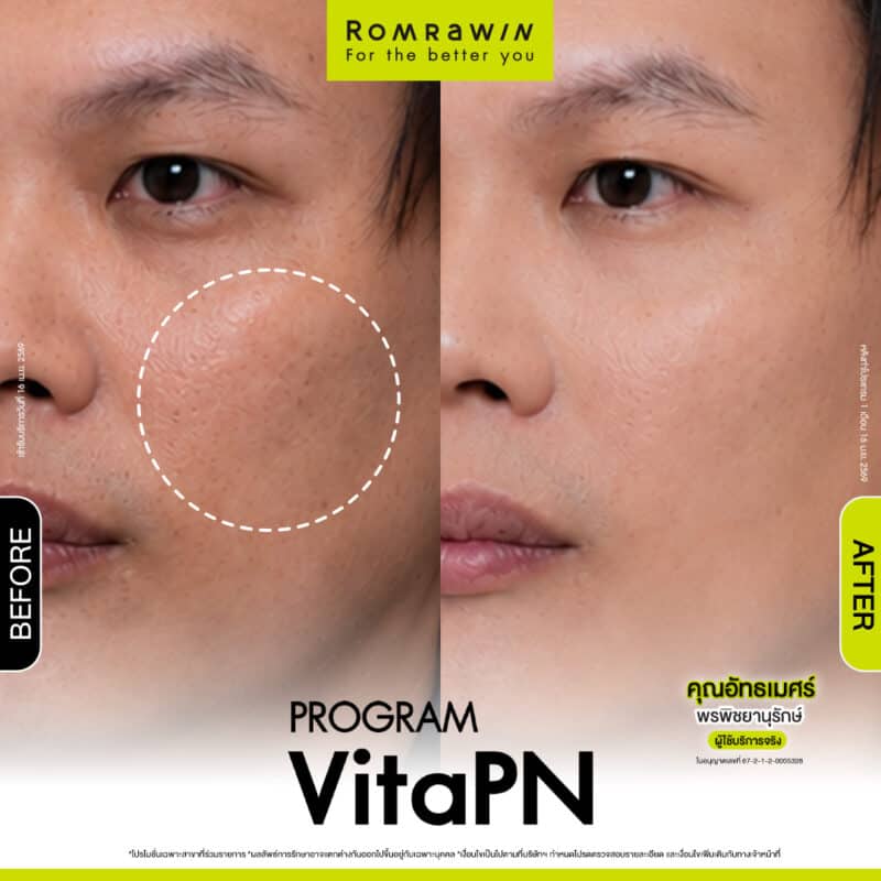 ผลลัพธ์ขึเ