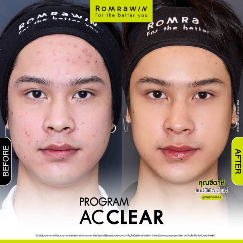 ผลลัพธ์ขึเ