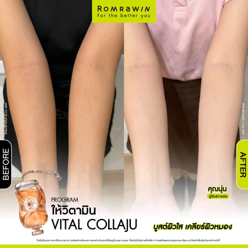 ผลลัพธ์ขึ้นอยู่กับแต่ละบุคคล