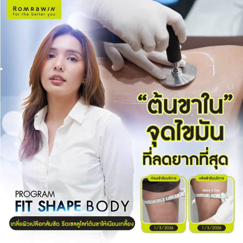 ผลลัพธ์ขึ้นอยู่กับแต่ละบุคคล