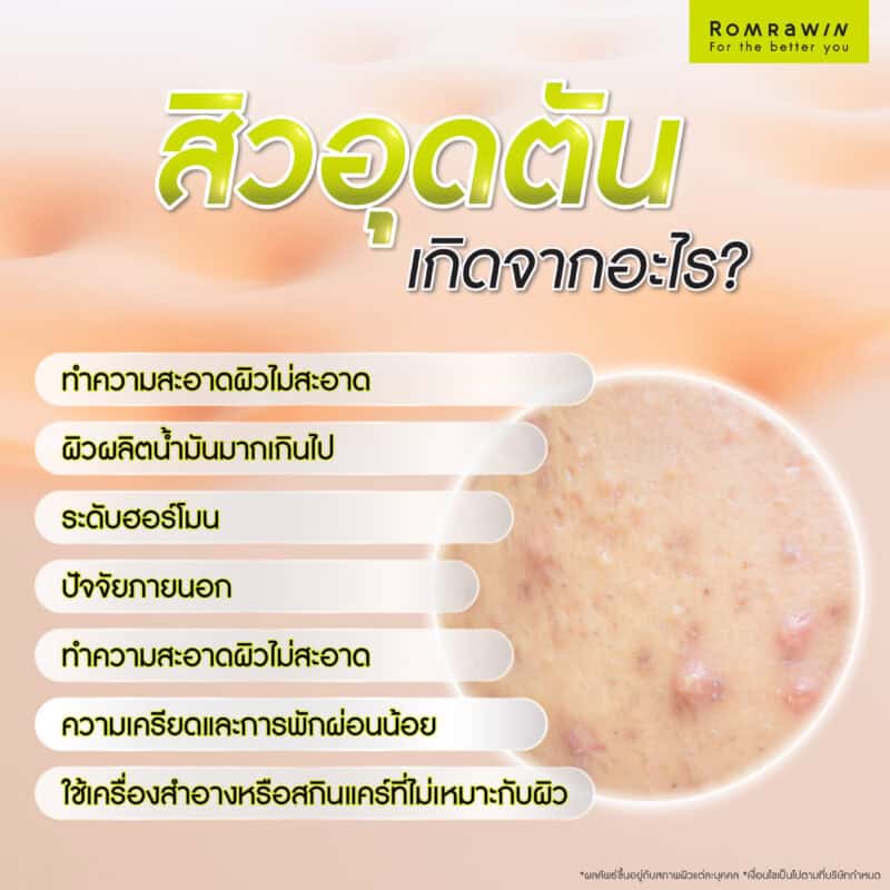 สิวอุดตันเกิดจากอะไร