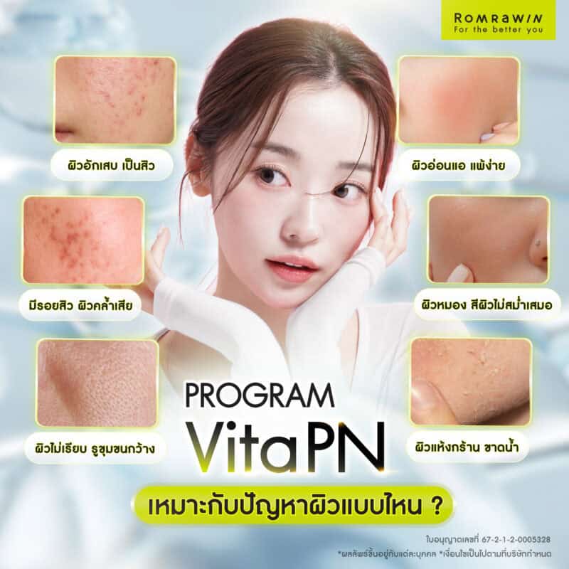 Vitaran เหมาะกับปัญหาผิวแบบไหน