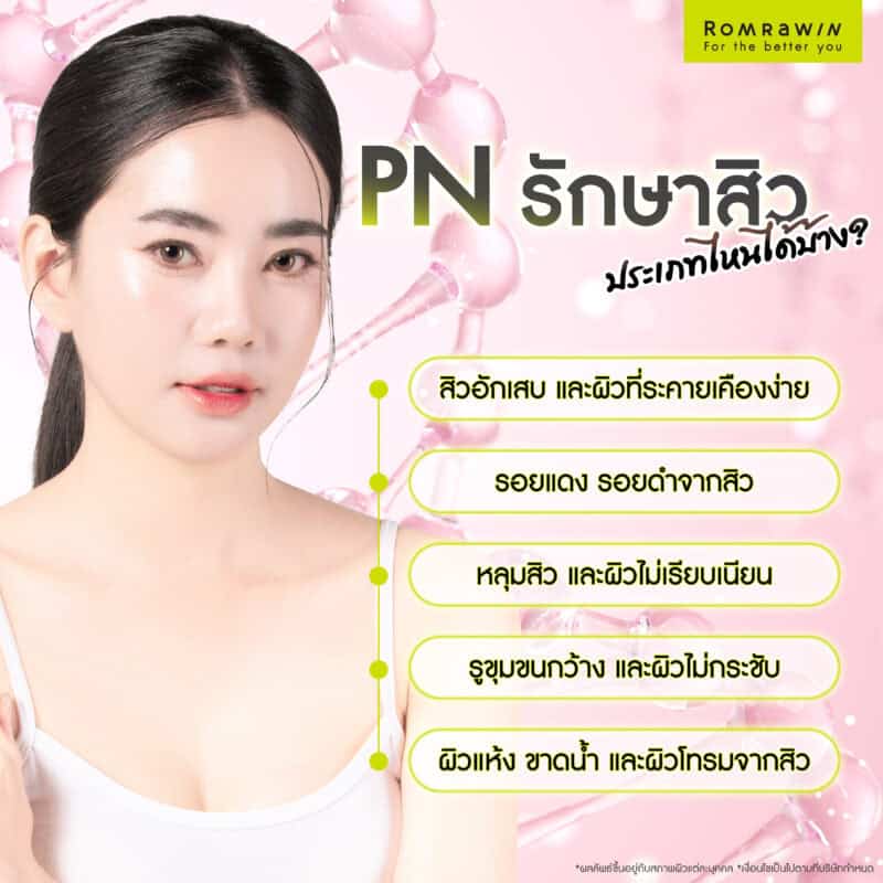 PN รักษาสิวประเภทไหนได้บ้าง?