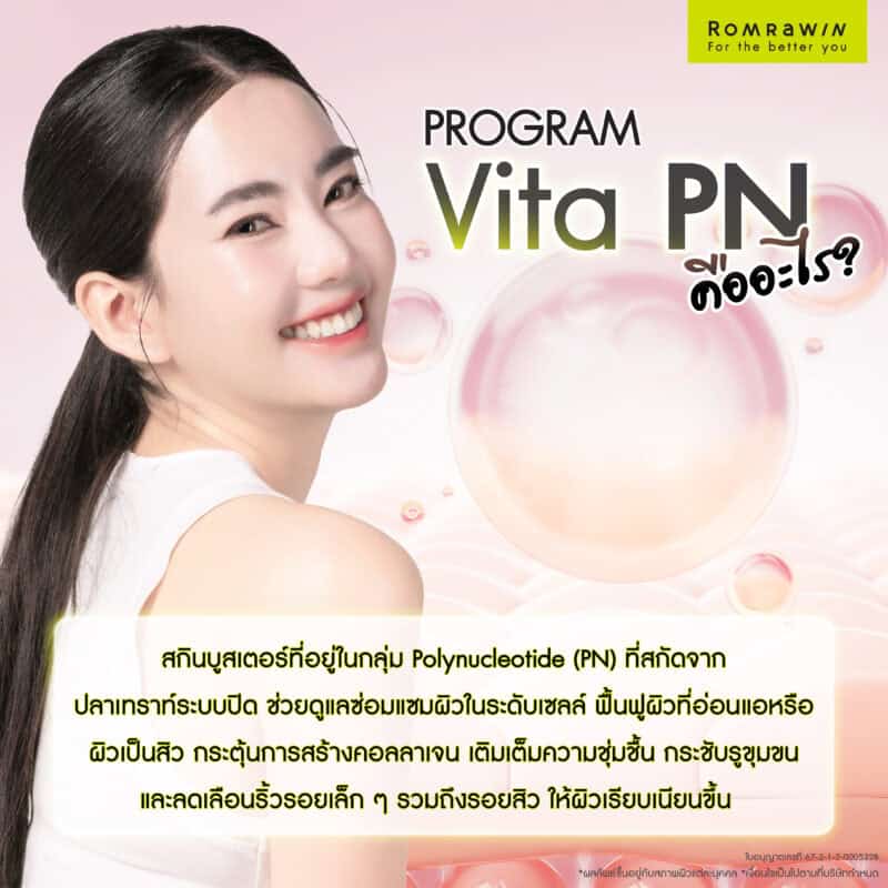 Vitaran I คืออะไร?