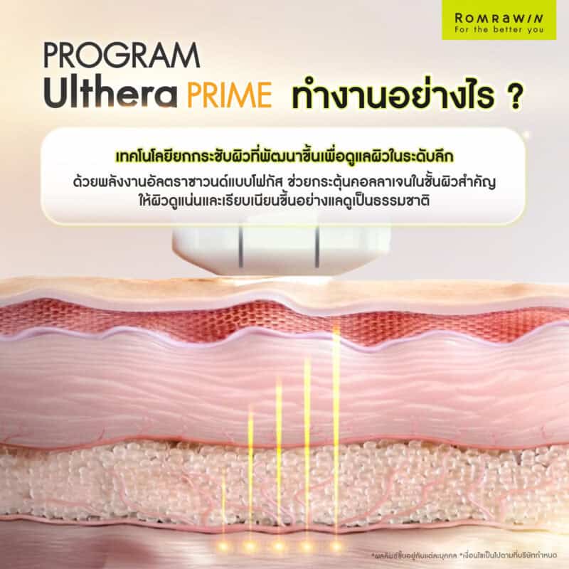 Ulthera PRIME ทำงานอย่างไร?