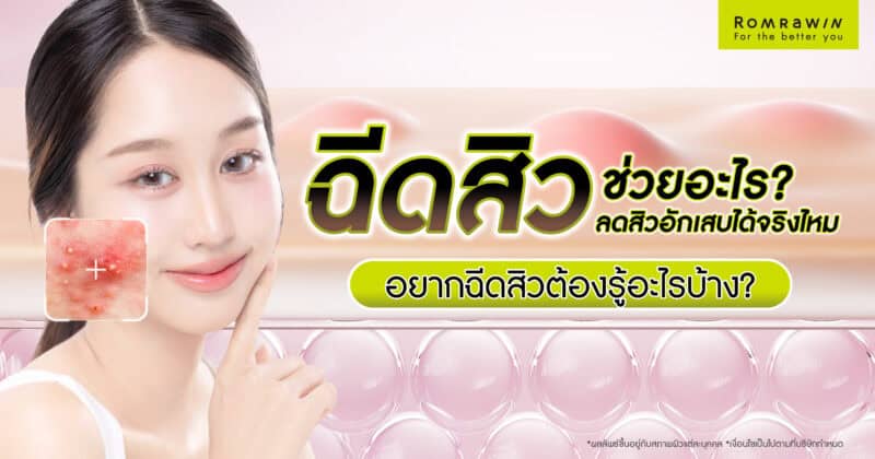 ฉีดสิว