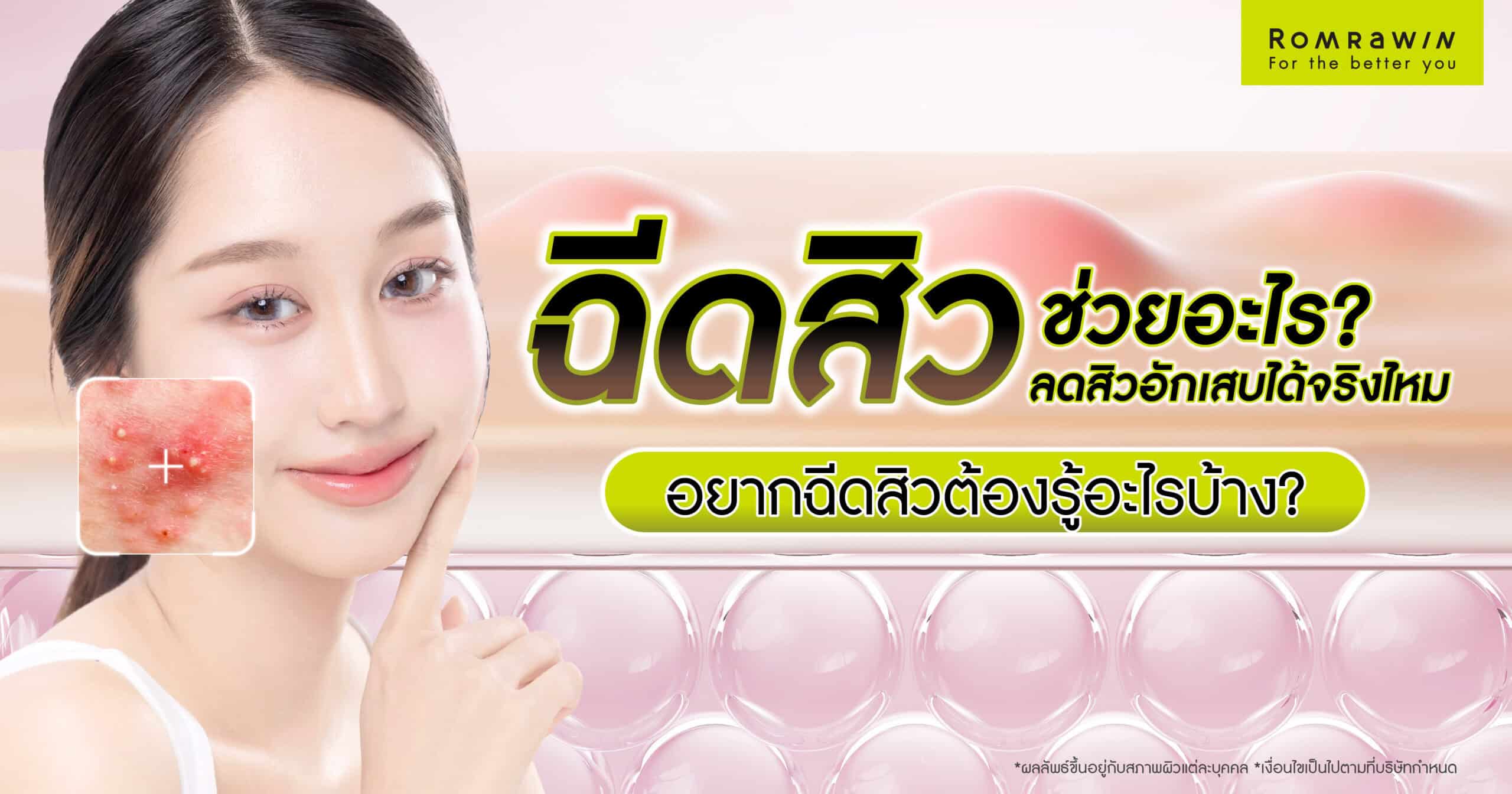 ฉีดสิว