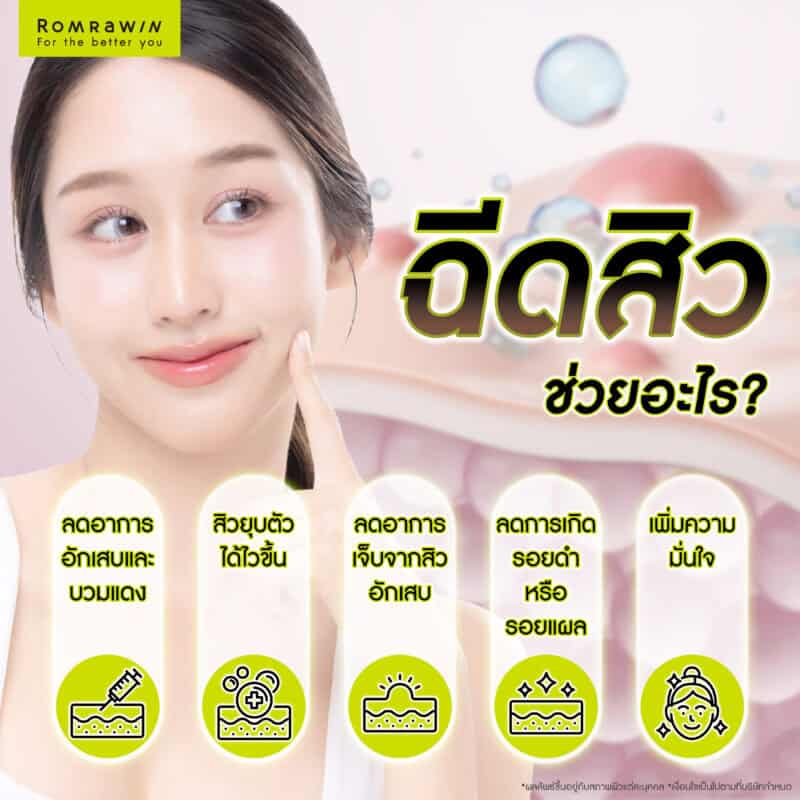 ฉีดสิวช่วยอะไร ?