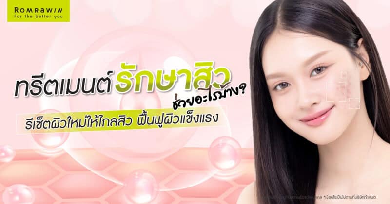 ทรีตเมนต์รักษาสิว