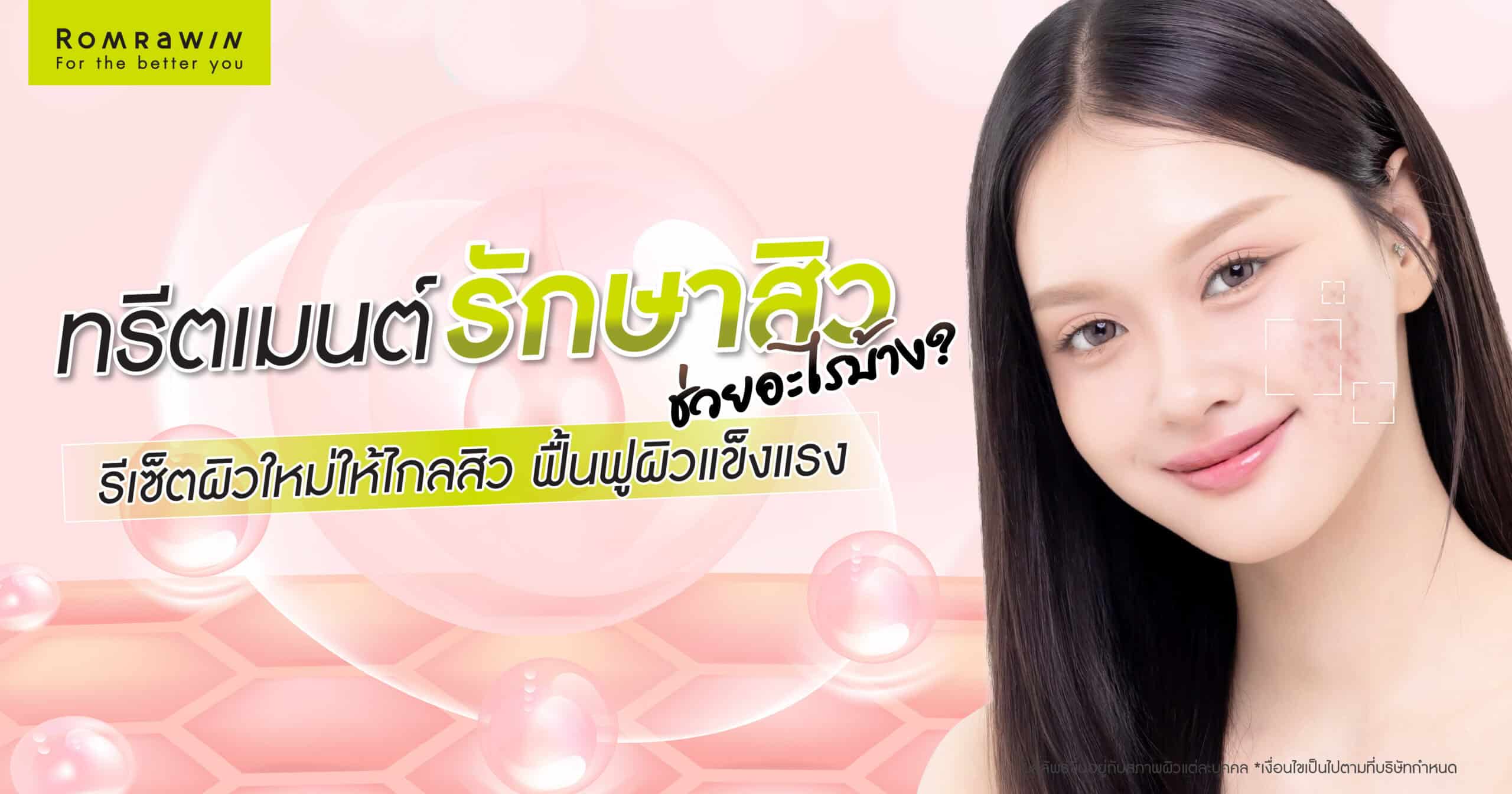 ทรีตเมนต์รักษาสิว