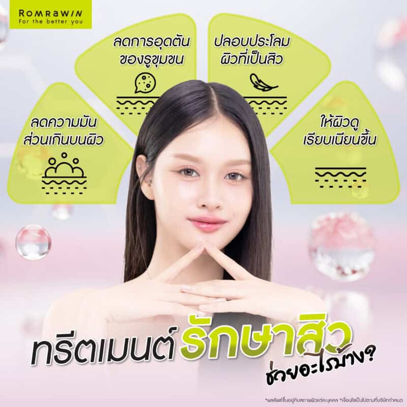 ทรีตเมนต์รักษาสิวช่วยอะไรบ้าง