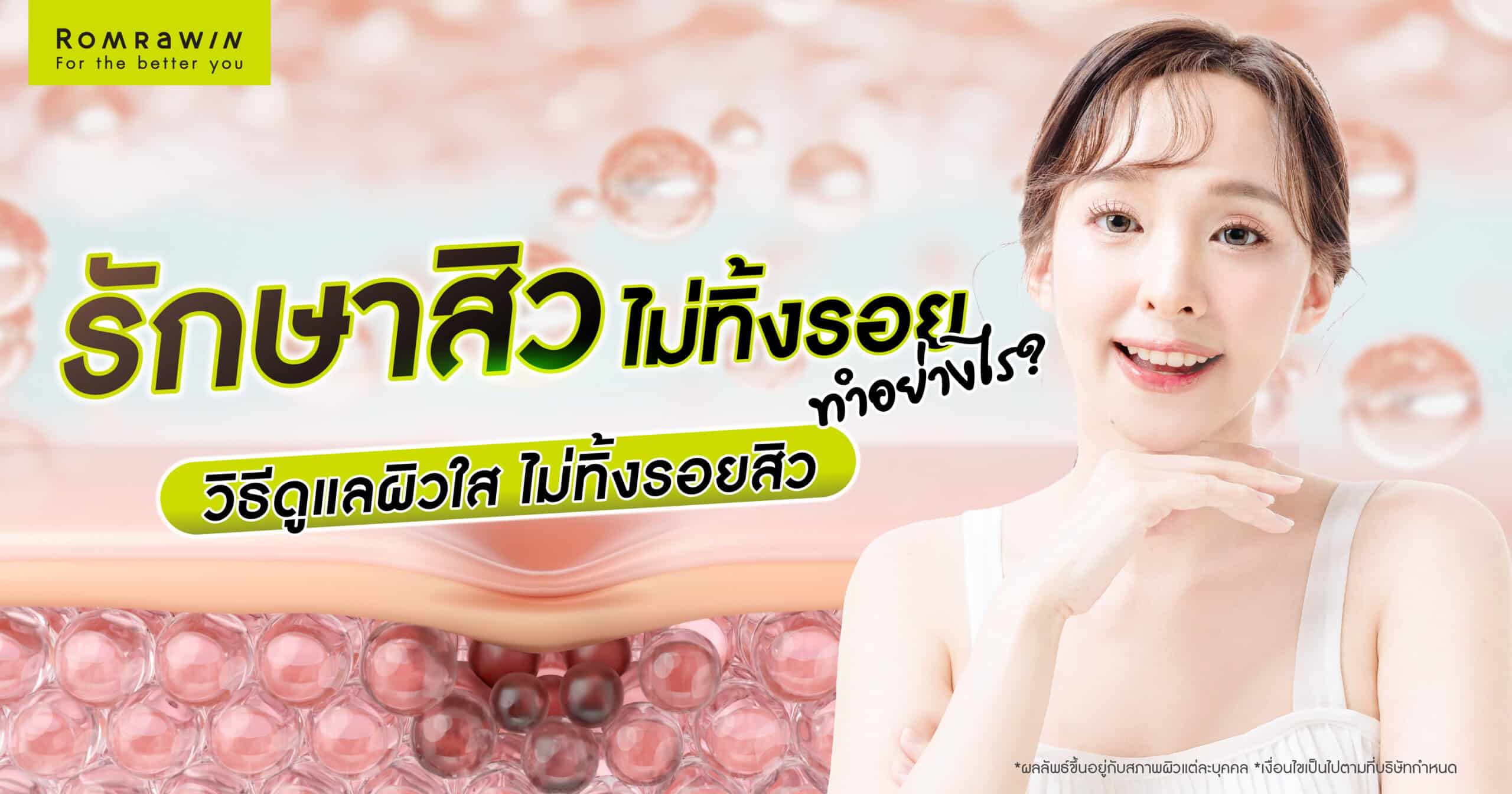 รักษาสิวไม่ทิ้งรอย