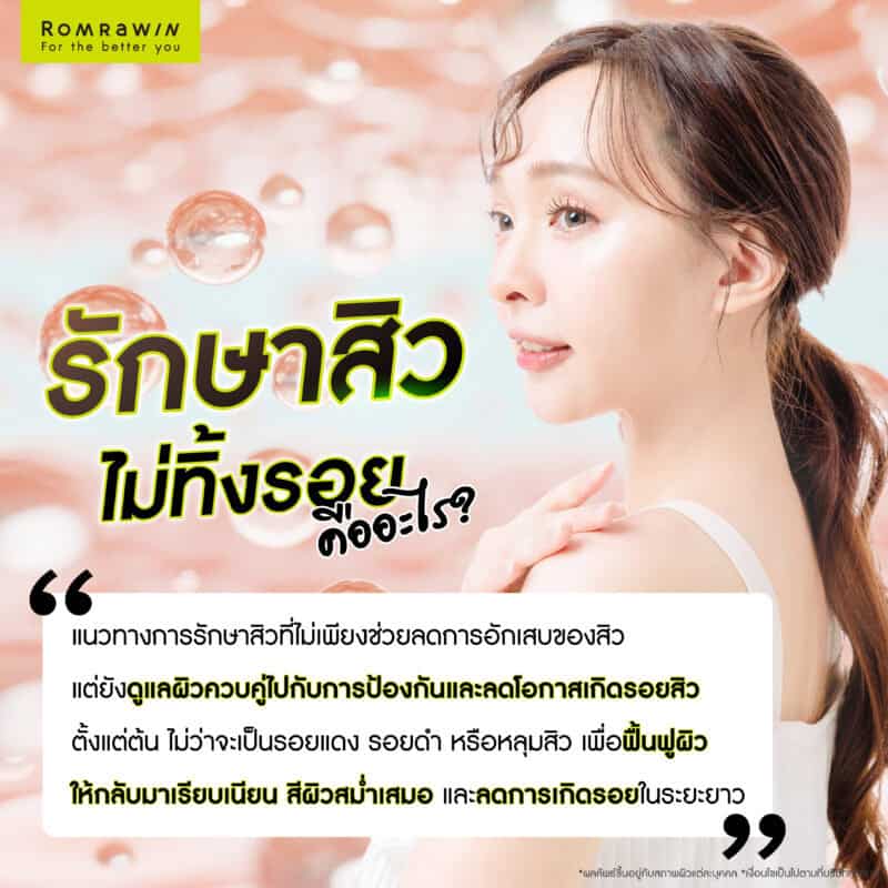 สิวหายแต่ทิ้งรอย เกิดจากอะไร