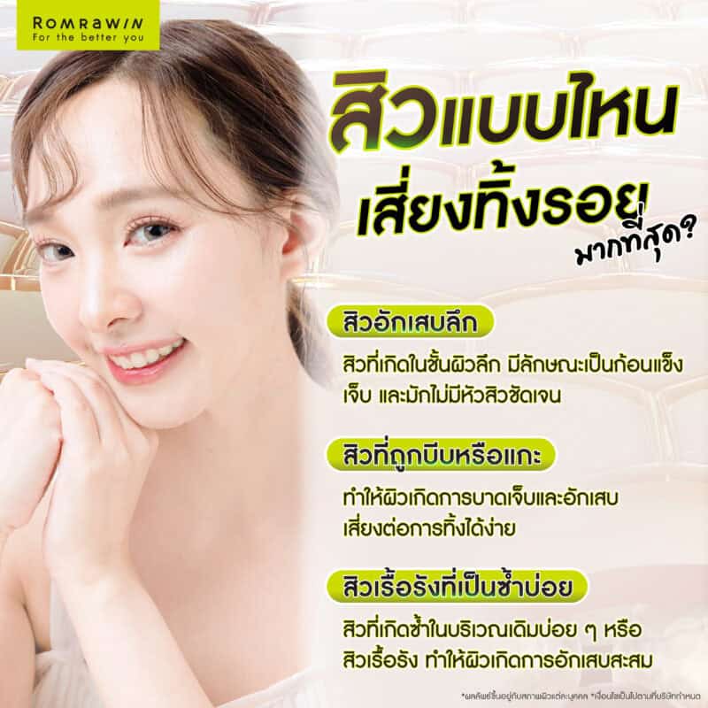 สิวแบบไหน เสี่ยงทิ้งรอยมากที่สุด