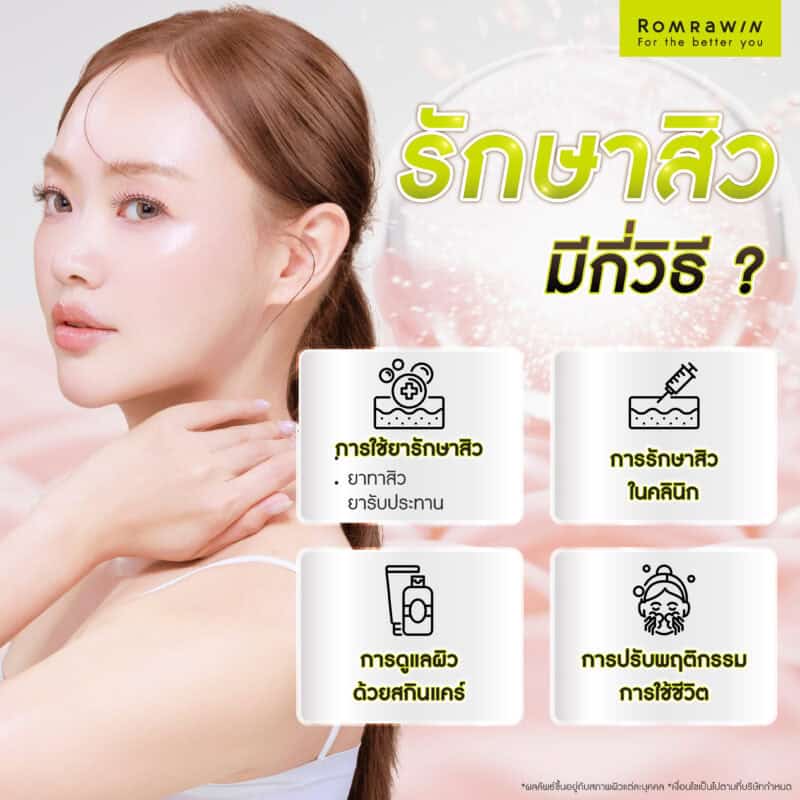 รักษาสิวมีกี่วิธี?