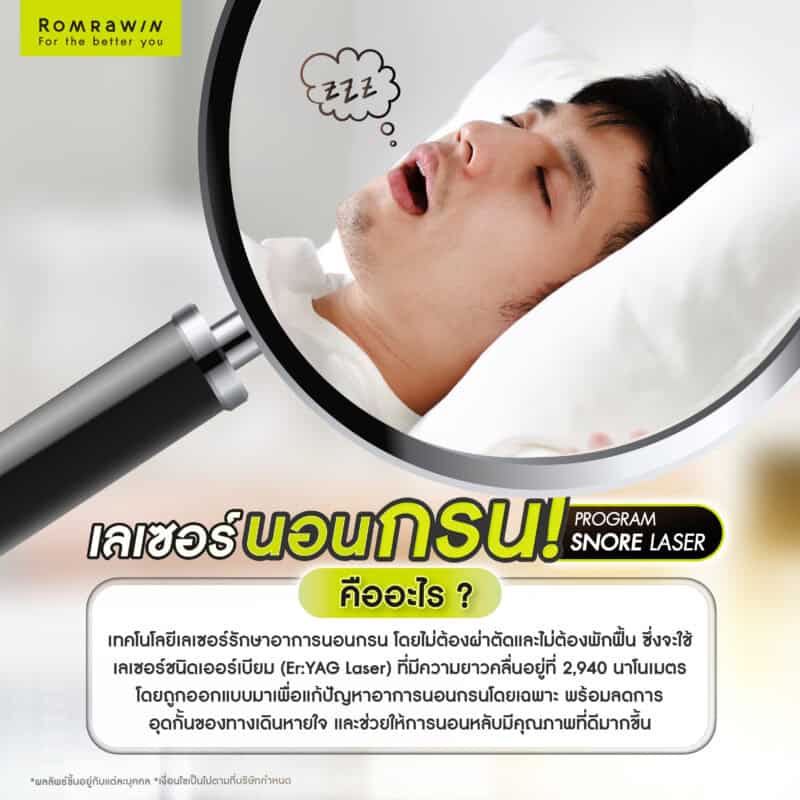 เลเซอร์แก้นอนกรนคืออะไร