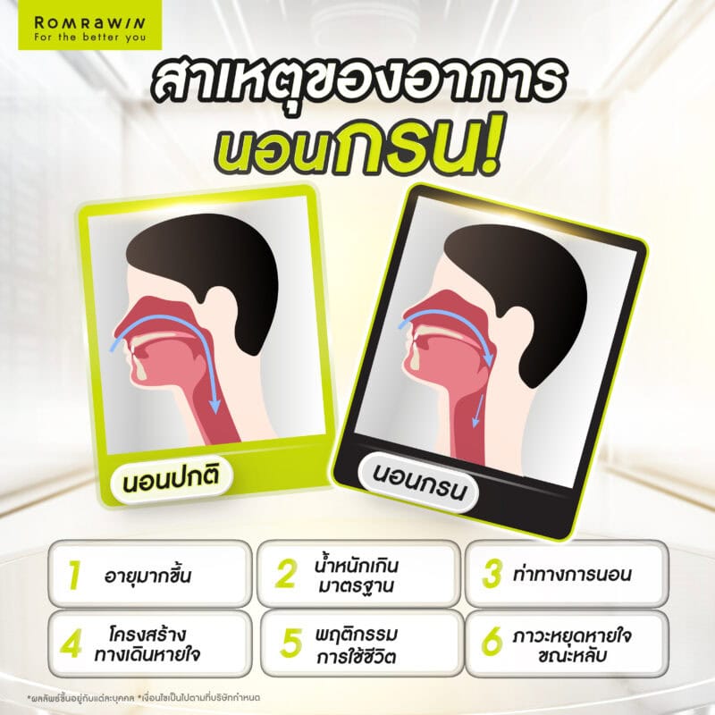 สาเหตุของอาการนอนกรน