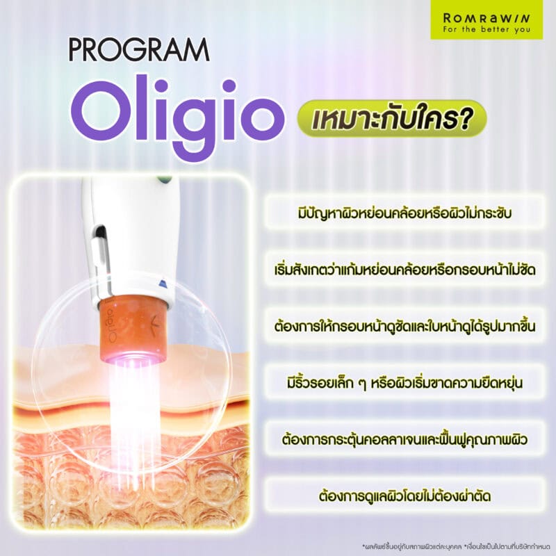 Oligio เหมาะกับใครบ้าง