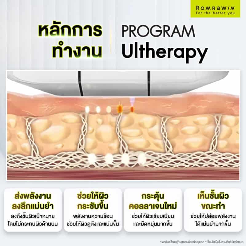 Ultherapy ทำงานอย่างไร?
