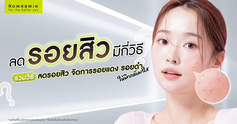 ลดรอยสิว