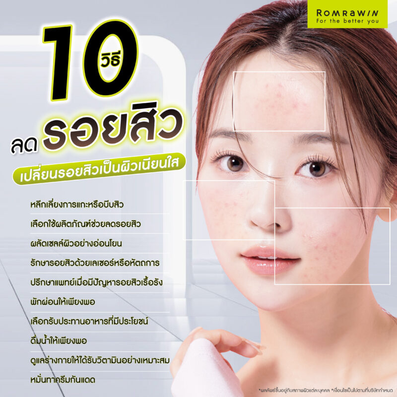 10 วิธีลดรอยสิว เปลี่ยนรอยสิวเป็นผิวเนียนใส