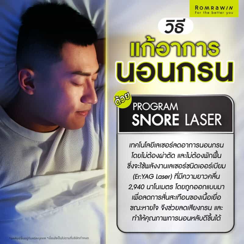 วิธีแก้อาการนอนกรนด้วย Snore Laser