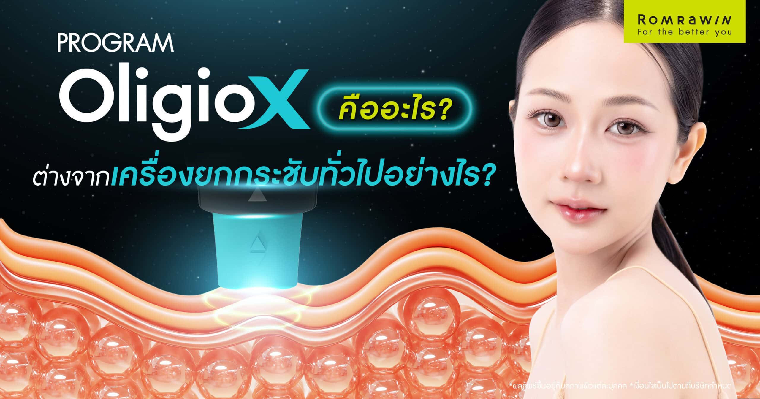 Oligio X是什么？它与其他皮肤紧致设备有何不同？