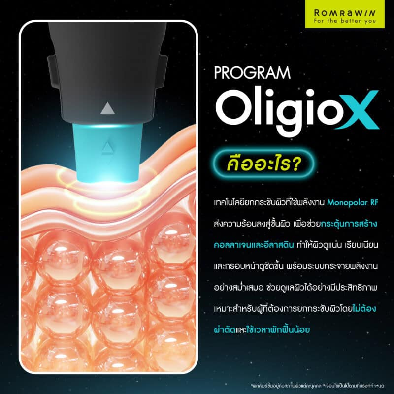 Oligio X คืออะไร