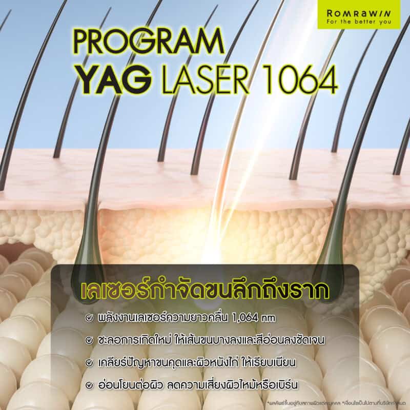 YAG Laser 1064 คืออะไร? เทคโนโลยีกำจัดขนลึกถึงรากเพื่อผิวเรียบเนียน