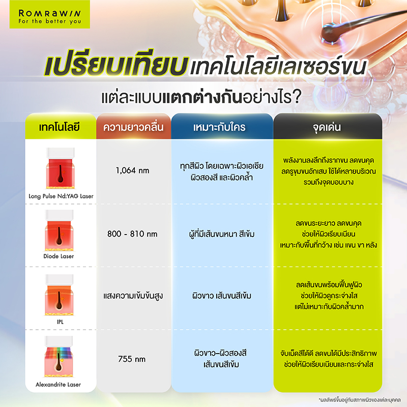 เปรียบเทียบเทคโนโลยีเลเซอร์ขน แต่ละแบบแตกต่างกันอย่างไร?