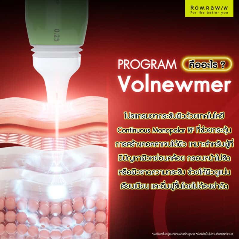 Volnewmer คืออะไร