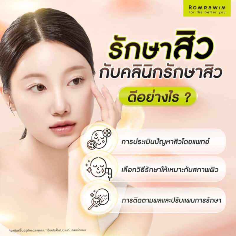 รักษาสิวกับคลินิกรักษาสิวดีอย่างไร?