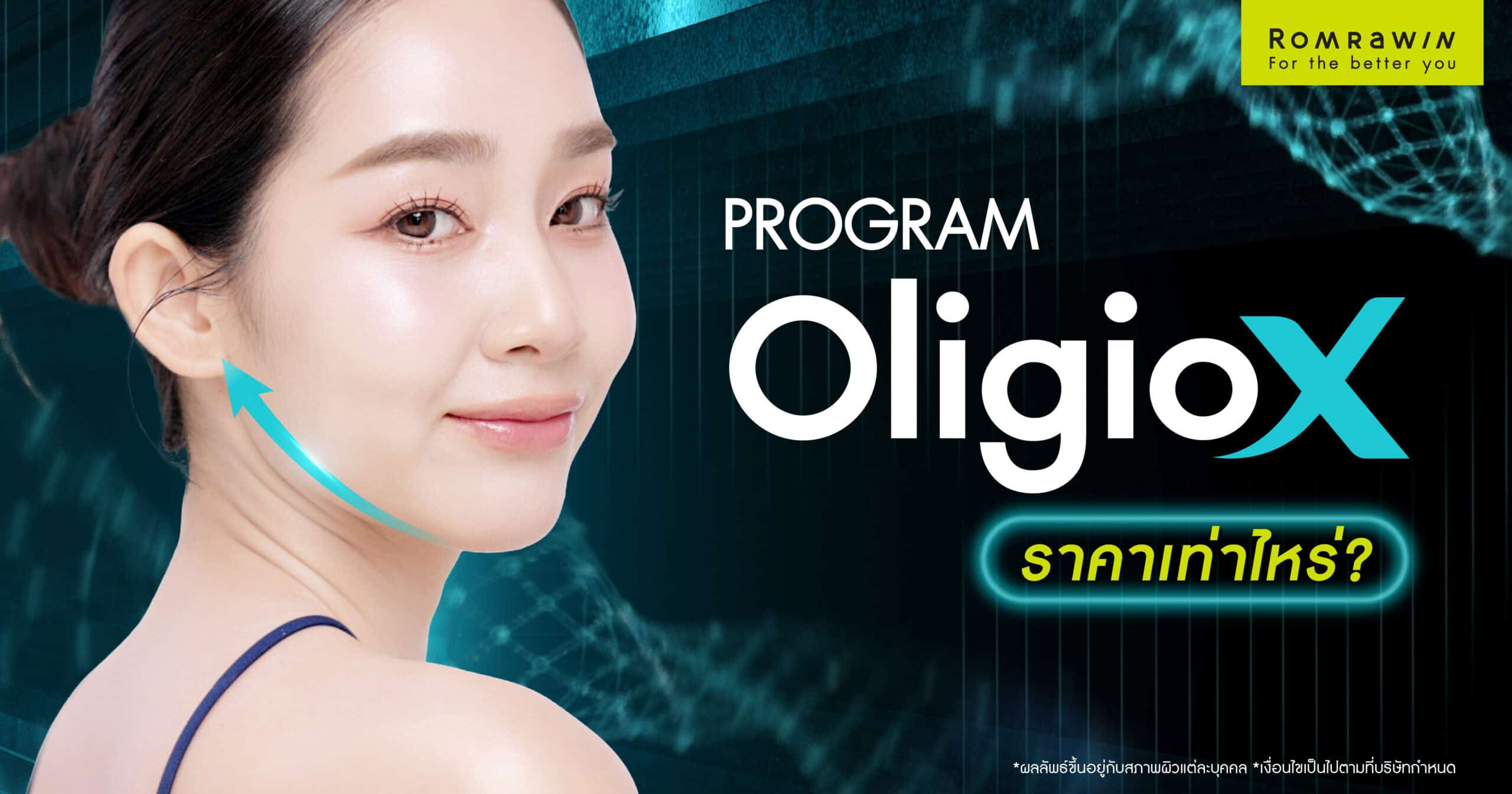 Oligio X ราคาเท่าไหร่? อัปเดตค่าใช้จ่าย พร้อมข้อควรรู้ก่อนทำ