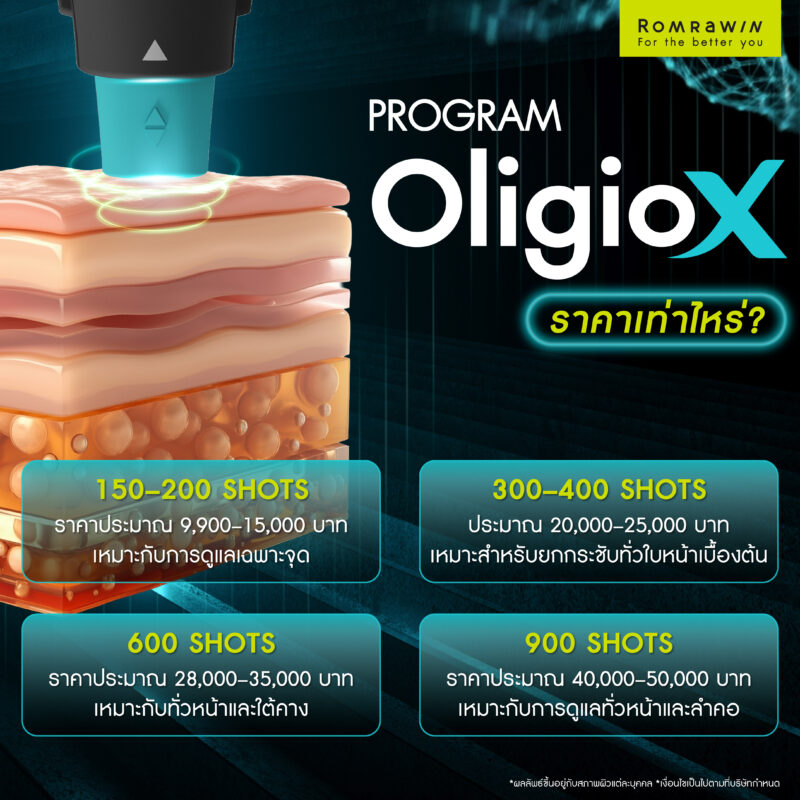 Oligio X ราคาเท่าไหร่