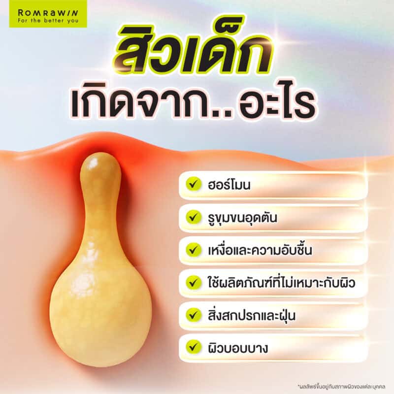 สิวเด็กเกิดจากอะไร