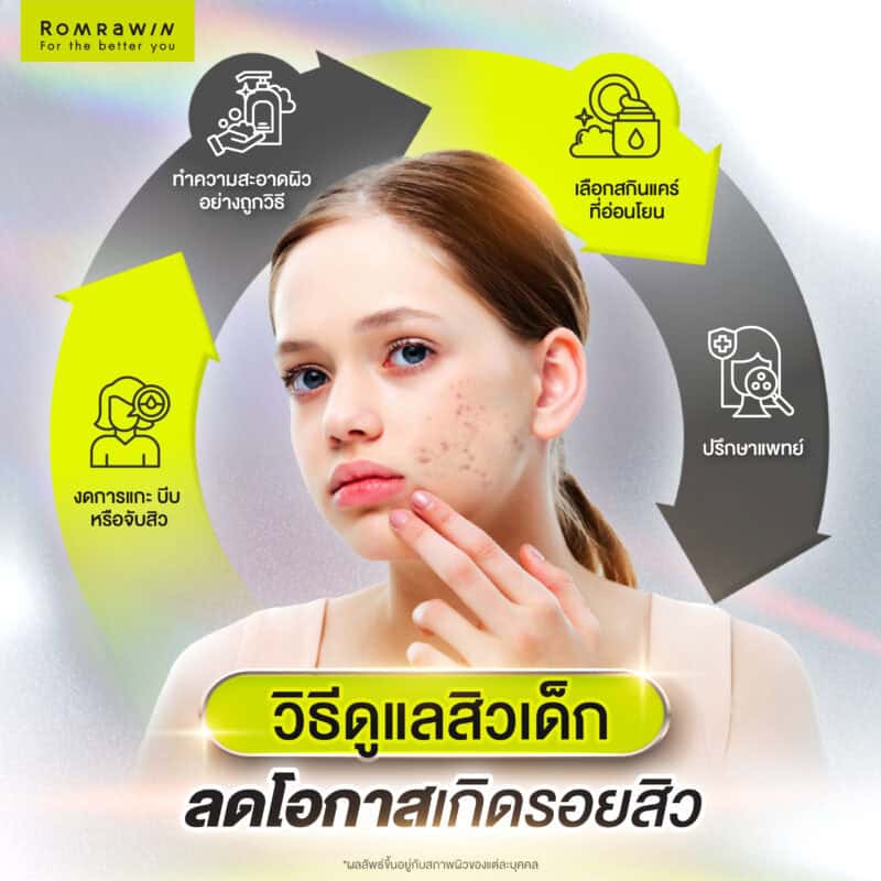 วิธีดูแลสิวเด็กอย่างอ่อนโยน ลดโอกาสเกิดรอยสิว