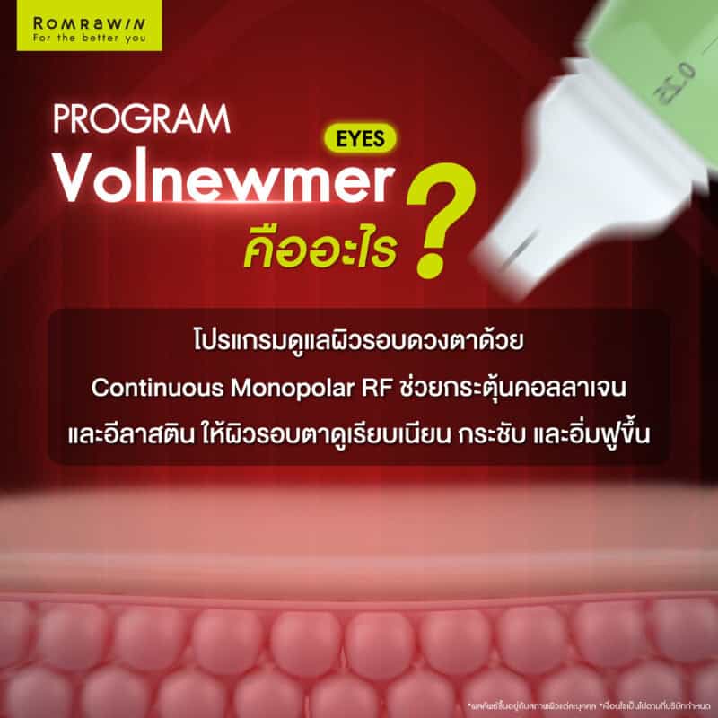 Volnewmer Eyes รอบดวงตา คืออะไร?