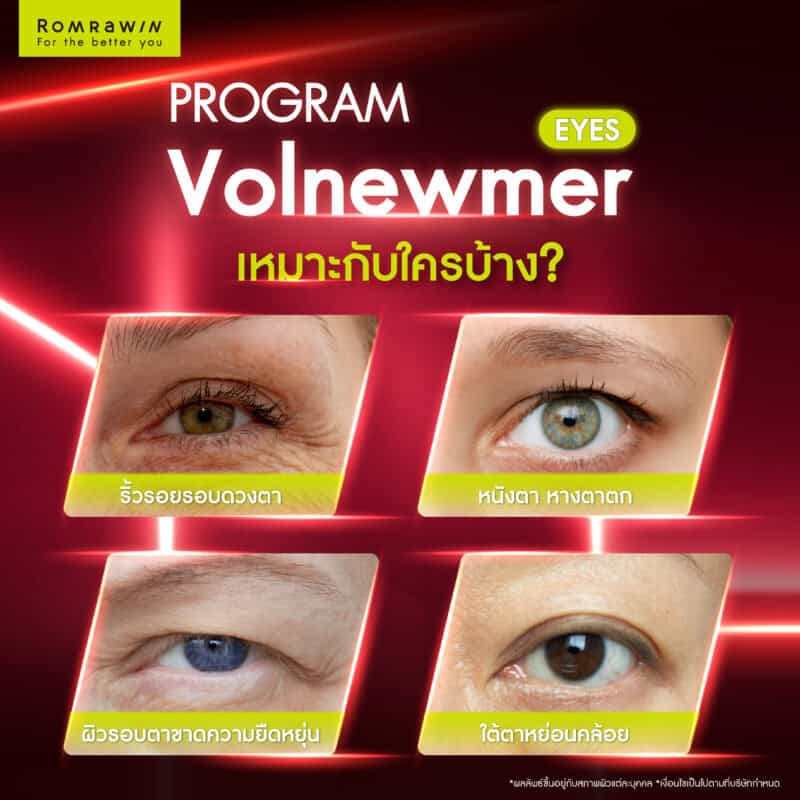 Volnewmer Eyes เหมาะกับใครบ้าง