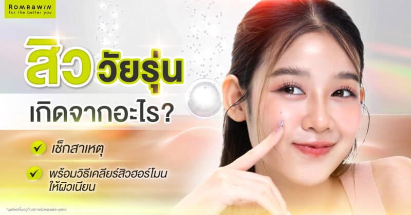 สิววัยรุ่น