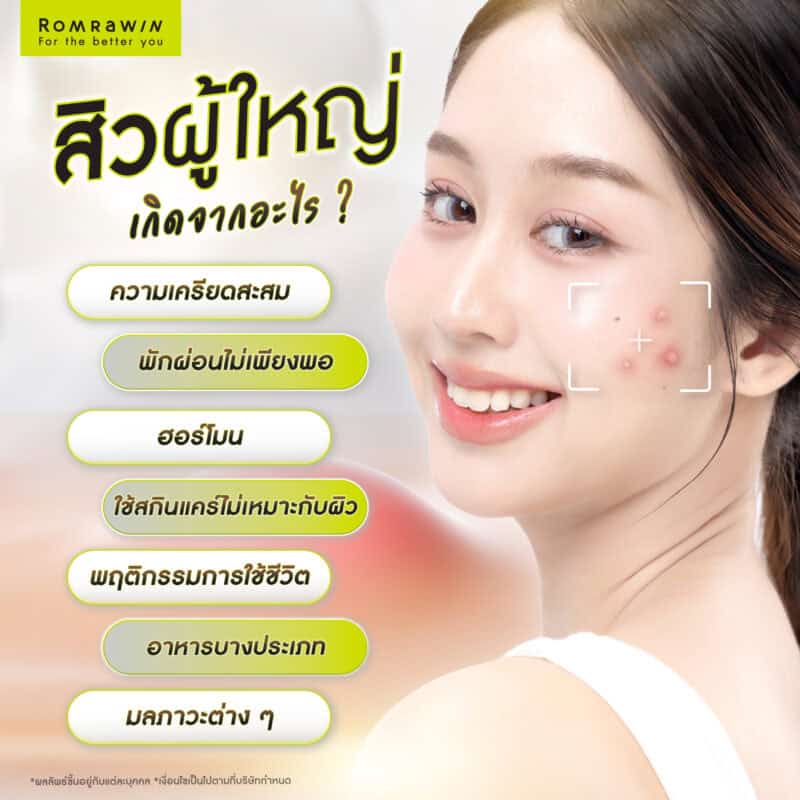 สิวผู้ใหญ่เกิดจากอะไร?