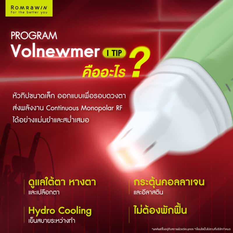 什么是 Volnewmer I Tip?