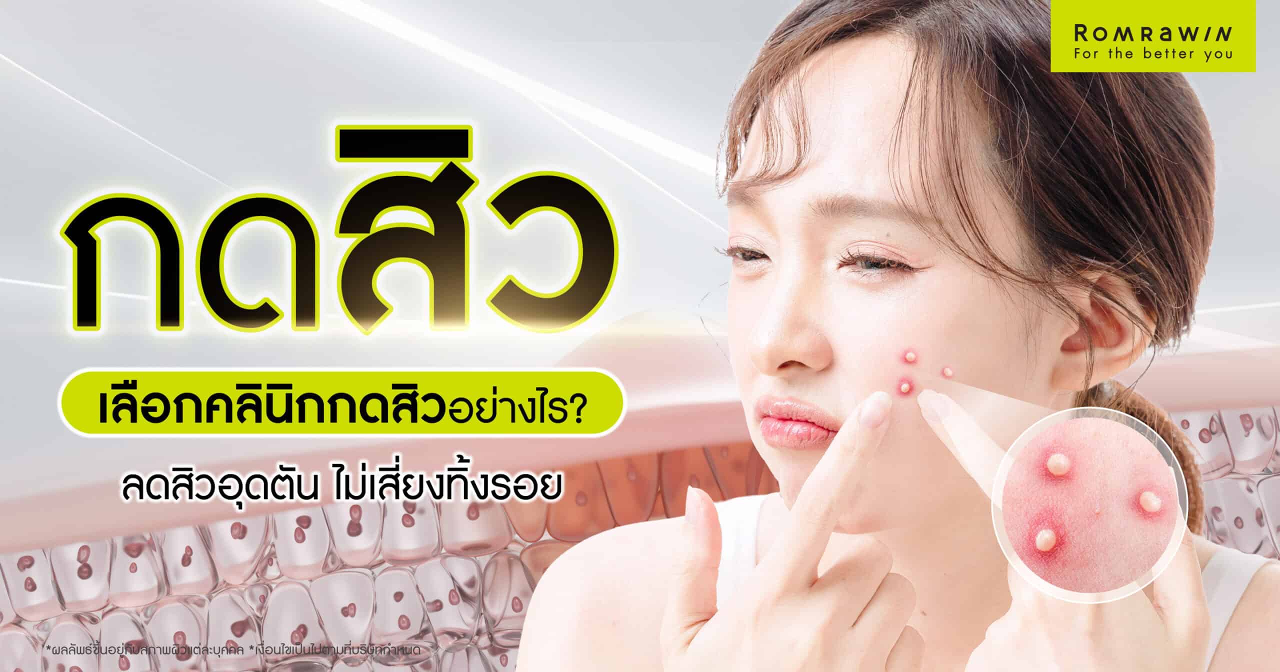 Where is a good place to get pimples squeezed?