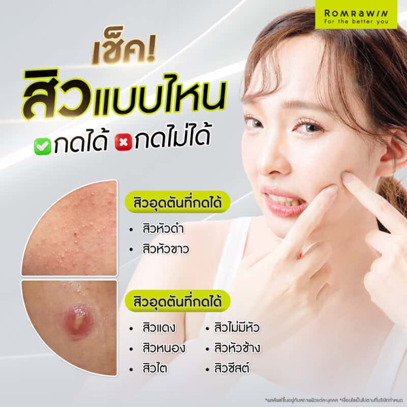 Which types of pimples should and shouldn't be squeezed? Check before you decide.