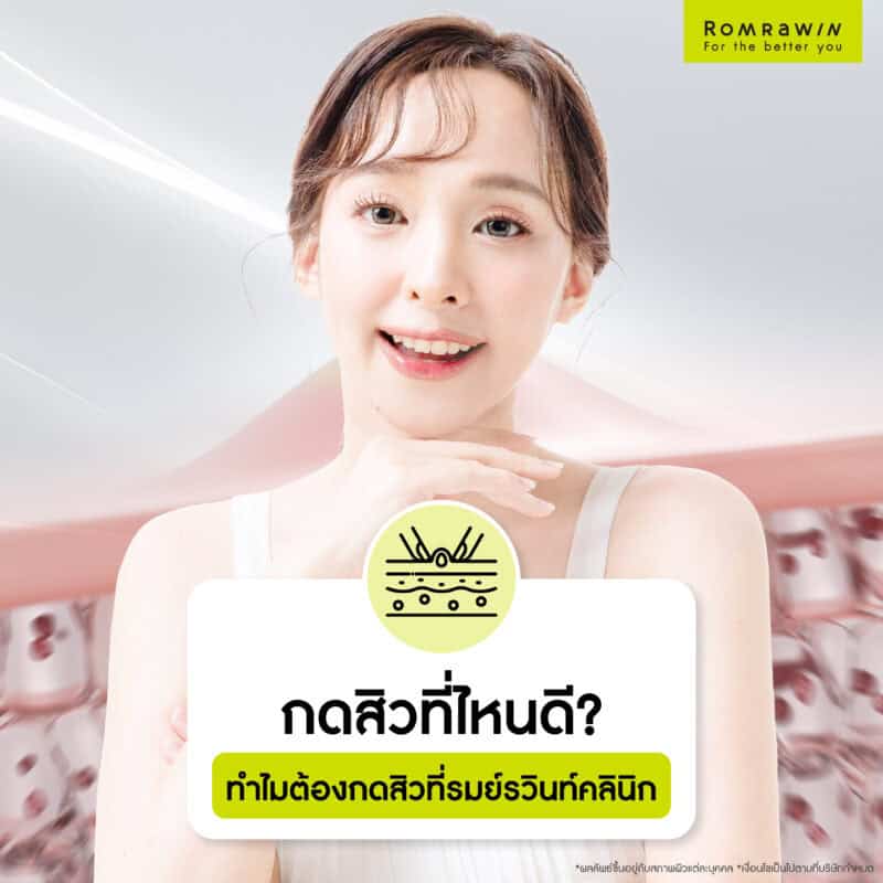 Where is the best place to get pimples extracted? Why choose Romrawin Clinic for pimple extraction?