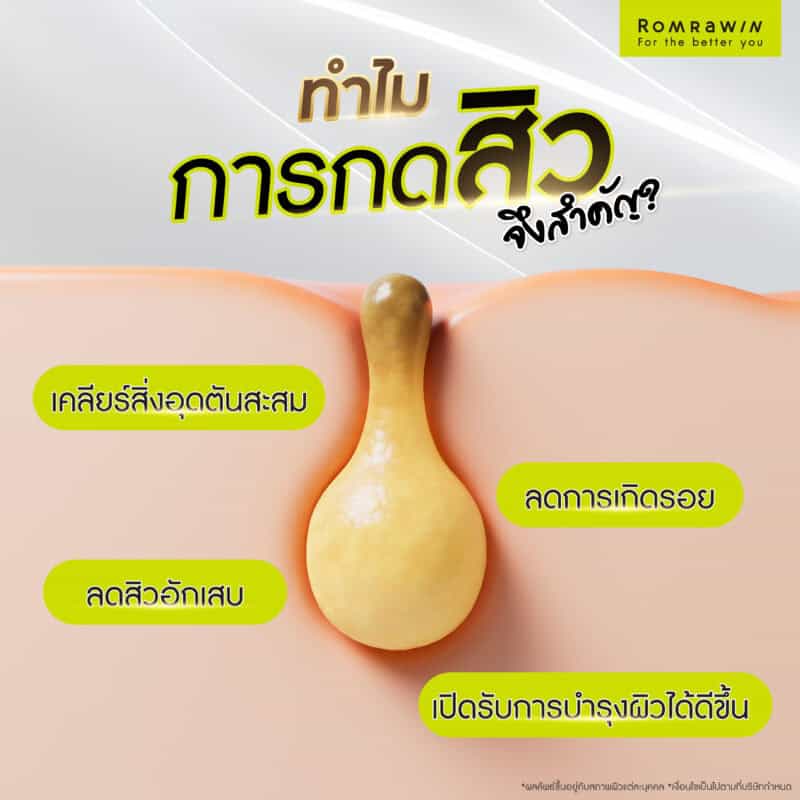 Where is the best place to get pimples extracted? Why choose Romrawin Clinic for pimple extraction?
