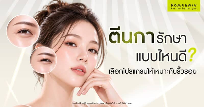 ตีนการักษาแบบไหนดี? เลือกเครื่องยกกระชับหรือโบให้เหมาะกับริ้วรอย